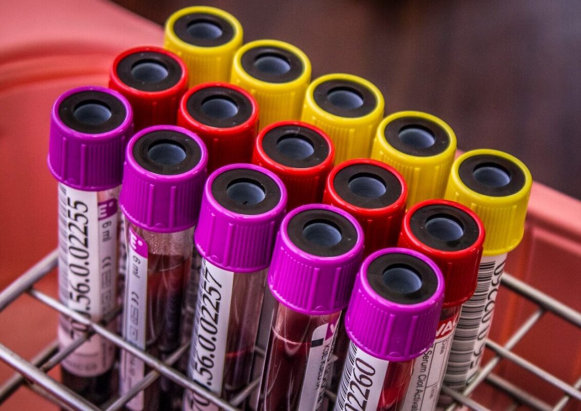 Hematíes bajos, Motivos y consecuencias