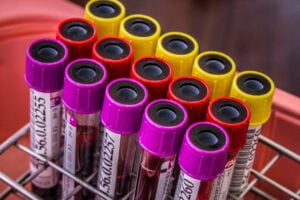 Hematíes bajos, Motivos y consecuencias