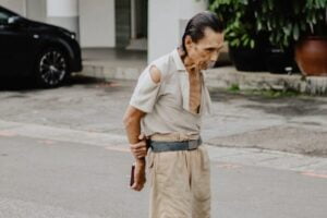 Creatinina baja, causas y síntomas