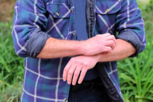 ¿Cómo se contagia la sarna? Características y formas de evitarla