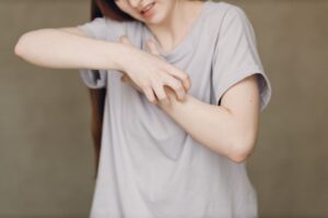 Causas del Eritema: Tratamiento y Tipos