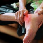 JUANETES » Causas, Síntomas y Complicaciones Corrector de Juanetes y Cómo Quitar el Dolor