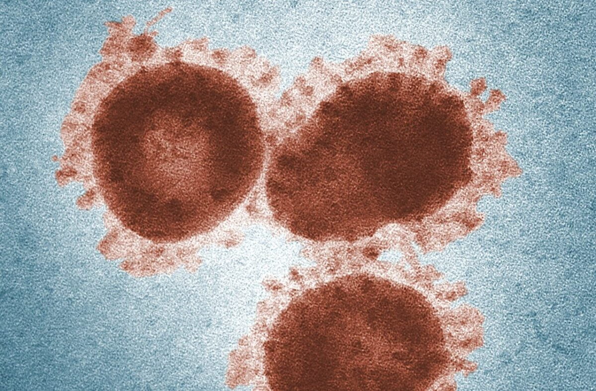 LINFOCITOS T » Qué son, Funciones y Características