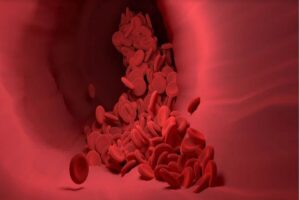 ÁCIDO LÁCTICO EN LA SANGRE