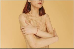 Efectos del Ácido Perclórico. Foto de Polina Tankilevitch. Pexels