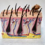 PIOJOS » Tipos, Formas de Eliminarlos, Remedios y Peligros PIOJOS EN LOS ADULTOS » Síntomas, causas y prevención