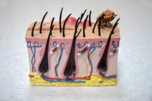 PIOJOS EN LOS ADULTOS » Síntomas, causas y prevención