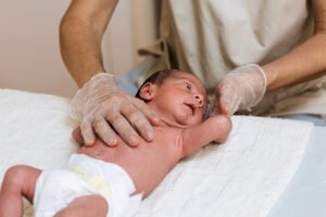 Galactorrea en recién nacidos