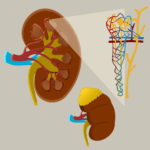 Tratamiento de la colangitis