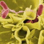 Salmonella. Photo by WikiImages. Pixabay.