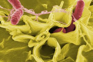 Salmonella. Photo by WikiImages. Pixabay.