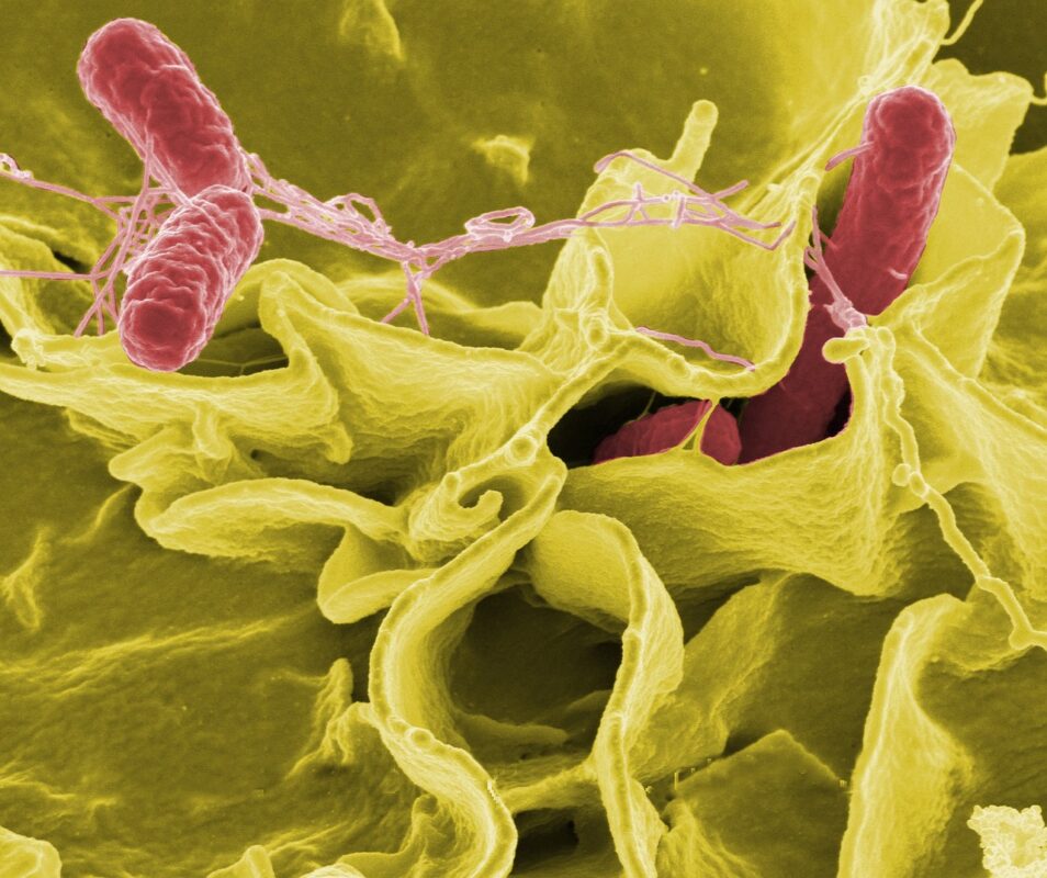 Salmonella. Photo by WikiImages. Pixabay.