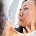 Dermatology, puberty Asian young woman, girl looking into mirror, allergy presenting an allergic rea